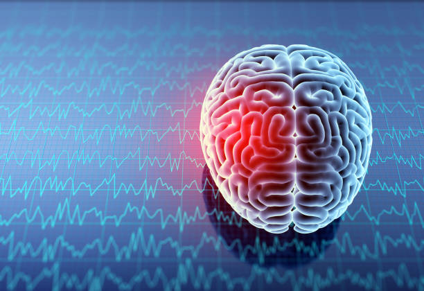 What is a traumatic brain injury (TBI)?